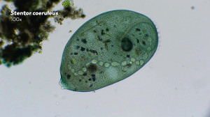 Stentors: Single Celled Giants