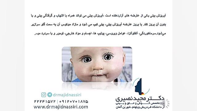 چرا دچار آبریزش بینی میشویم؟