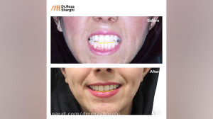 روند درمان ارتودنسی  دکتر رضا...