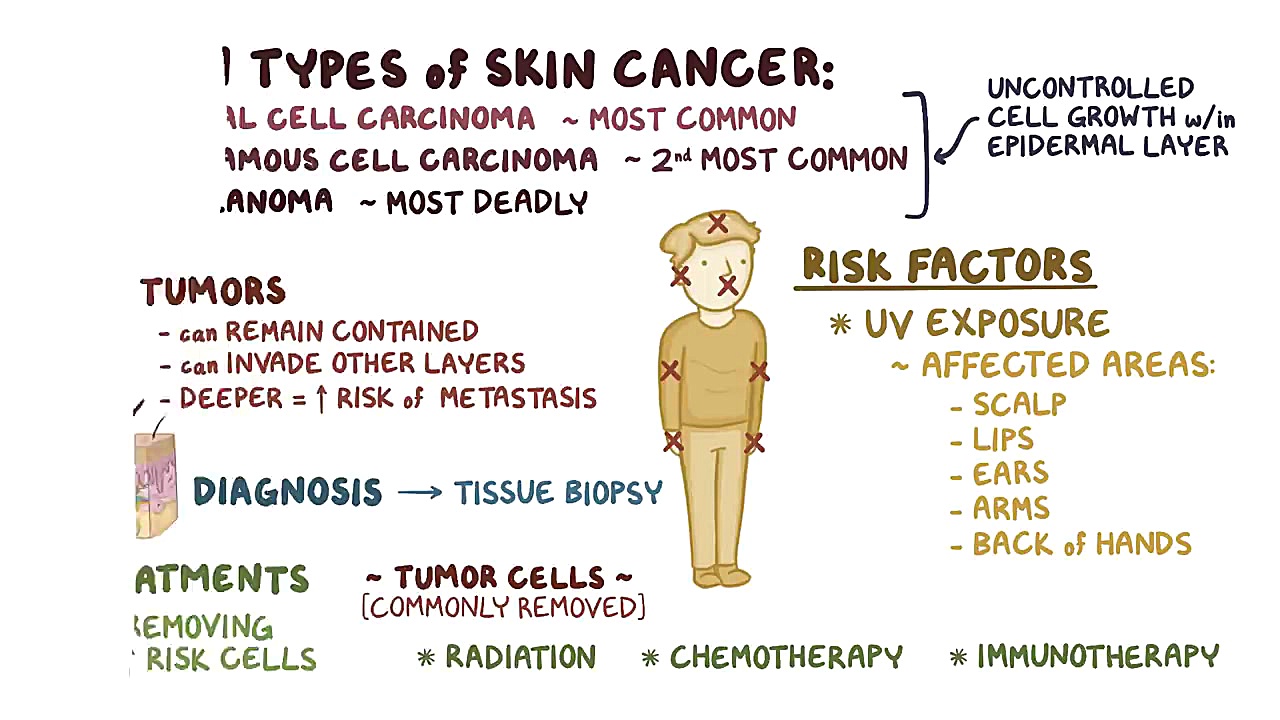 Skin cancers