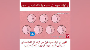 چگونه سرطان سینه را خودتان تشخ...