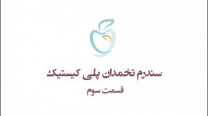 تنبلی تخمدان یا سندرم تخمدان پ...