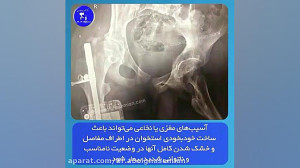 فیلم آسیب نخاعی