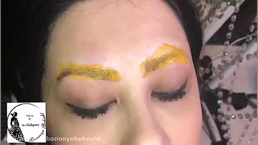 تفاوت فیبروز و میکروبلیدینگ ،...