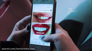 دندانپزشکی ترمیمی و زیبایی دنت...