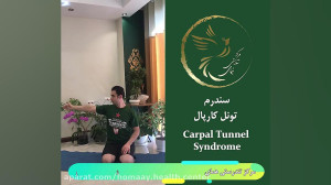 سندرم تونل کارپال