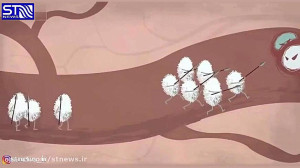 همه چیز در مورد سرطان خون