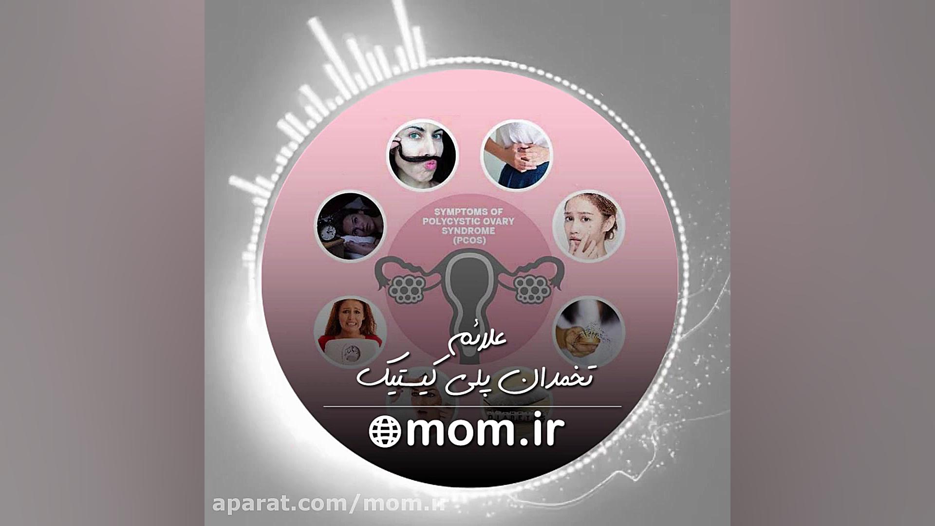 علائم تخمدان پلی کیستیک