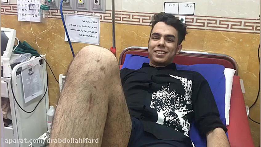 جراحی رباط صلیبی بعد از یک ماه