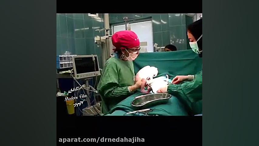 فیلم زایمان سزارین توسط دکتر ن...