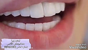 طریقه اصلاح طرح لبخند | بهترین...