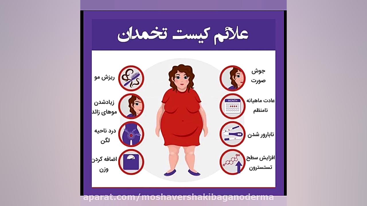 درمان تخمدان پلی کیستیک