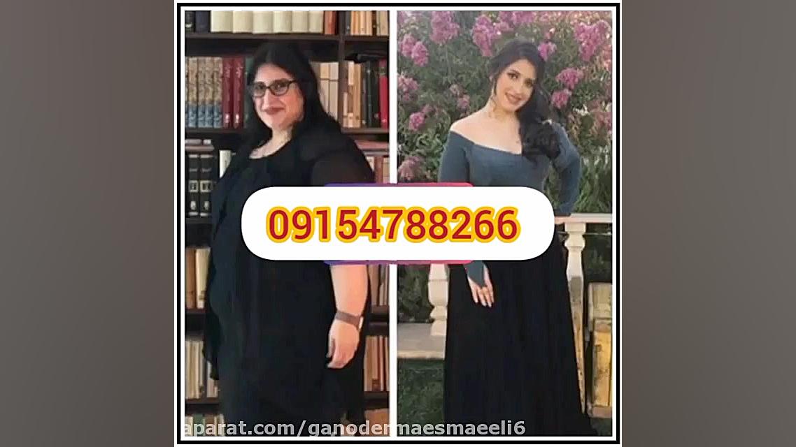 درمان قطعی چاقی با استفاده از...