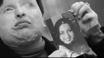 تصاویری از ماجرای اسید پاشی اص...