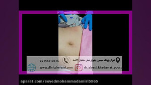لاغری و لیفت شکم و پهلو با دست...