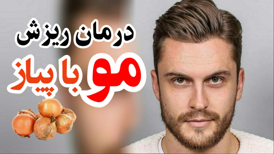 درمان ریزش مو با پیاز