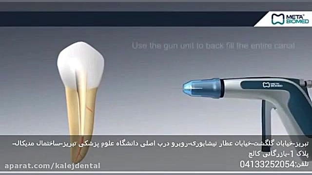 آبچوراتور متا