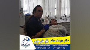 درمان جای جوش با پانچ