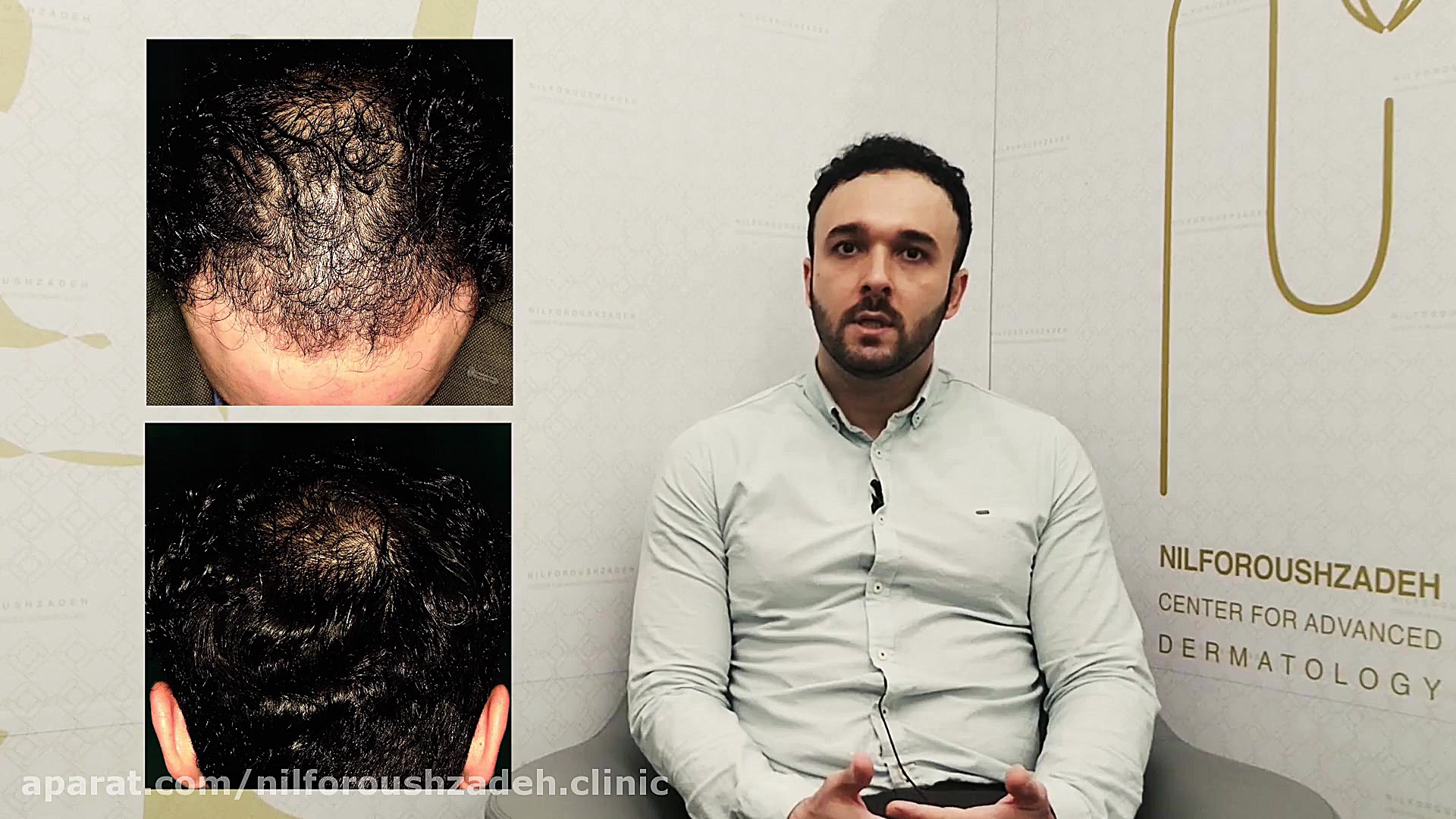 رضایت مراجع کاشت مو