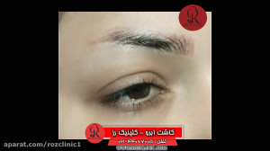 کاشت ابرو | فیلم کاشت ابرو | ک...