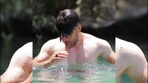 ترمیم مو با استفاده از پروتز م...