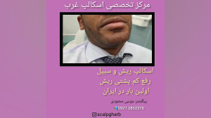 میکرواسکالپ ریش و سیبیل