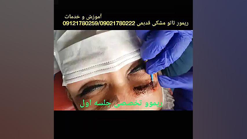 ریمو تاتو قدیمی با رنگ مشکی