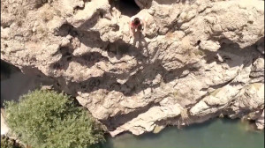 ترمیم مو با استفاده از پروتز م...