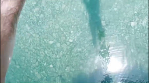 ترمیم مو با استفاده از پروتز م...