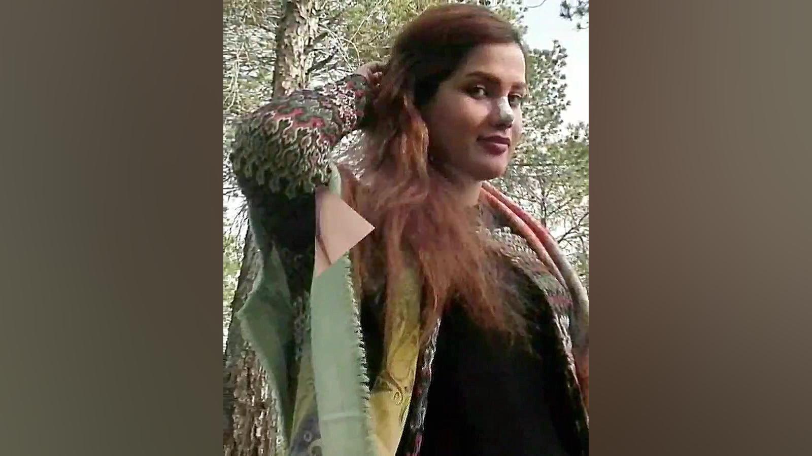 نمونه جراحی بینی دکتر حبیب سهر...