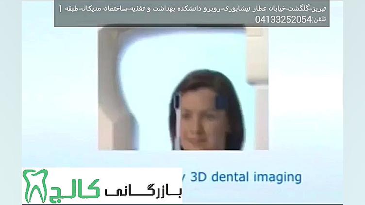 اپکس فایندر کوکسو