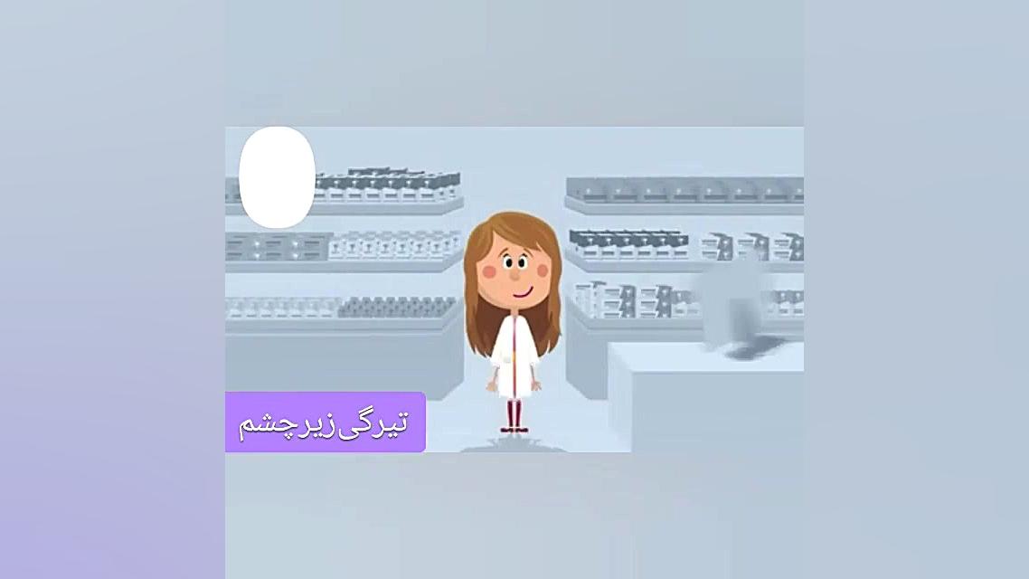 تیرگی زیر چشم
