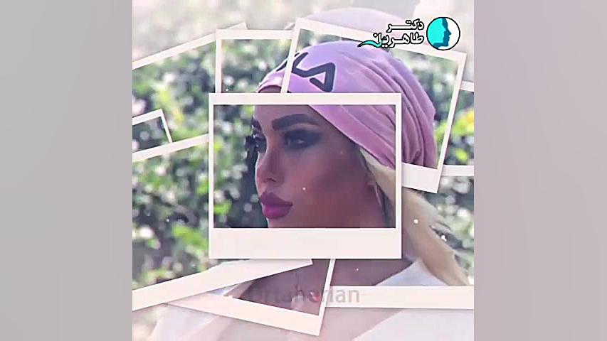 نمونه کارهای جراحی بینی