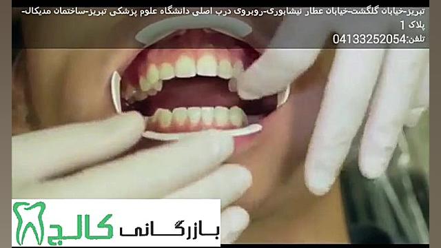 دهان باز کن قابل اتوکلاو KERR