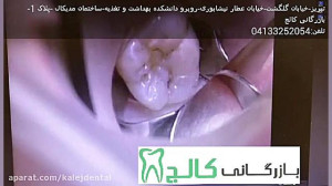 کامپوزیت سرامیکی NORDISKA