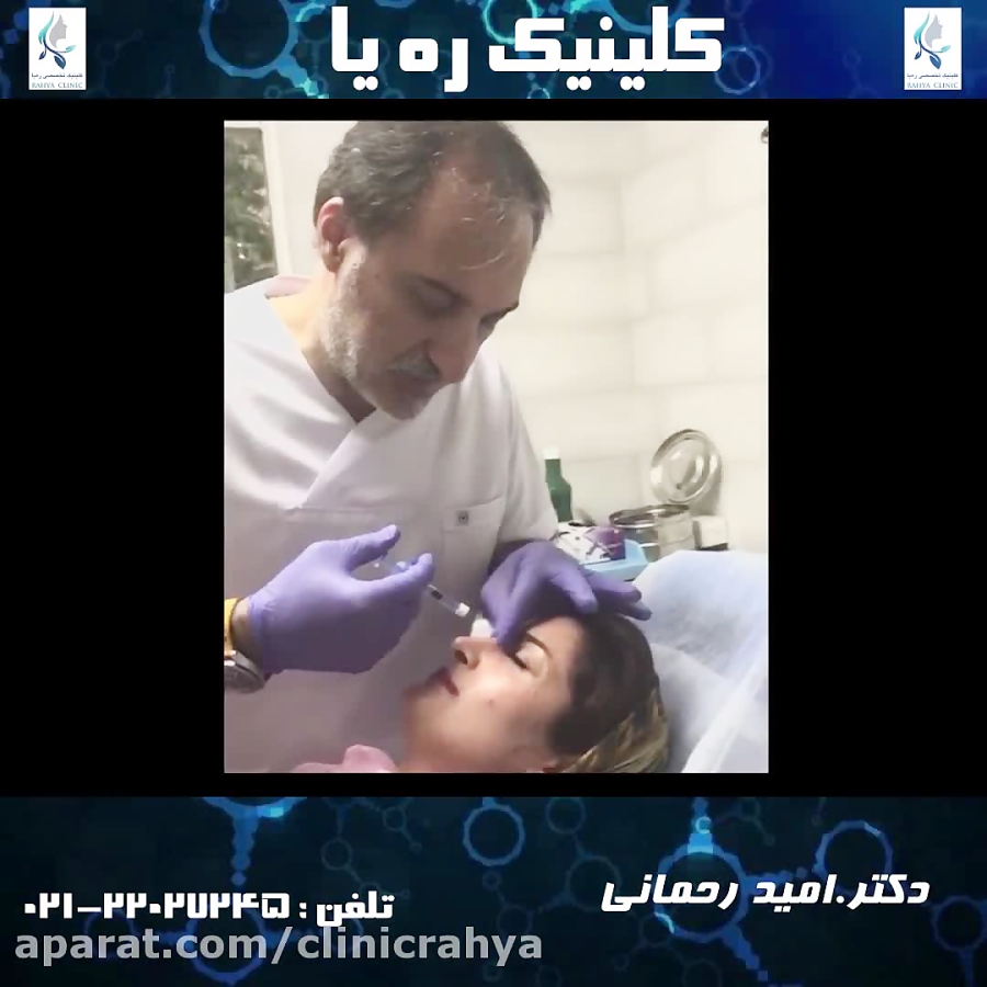 فرم دهی بینی با فیلر