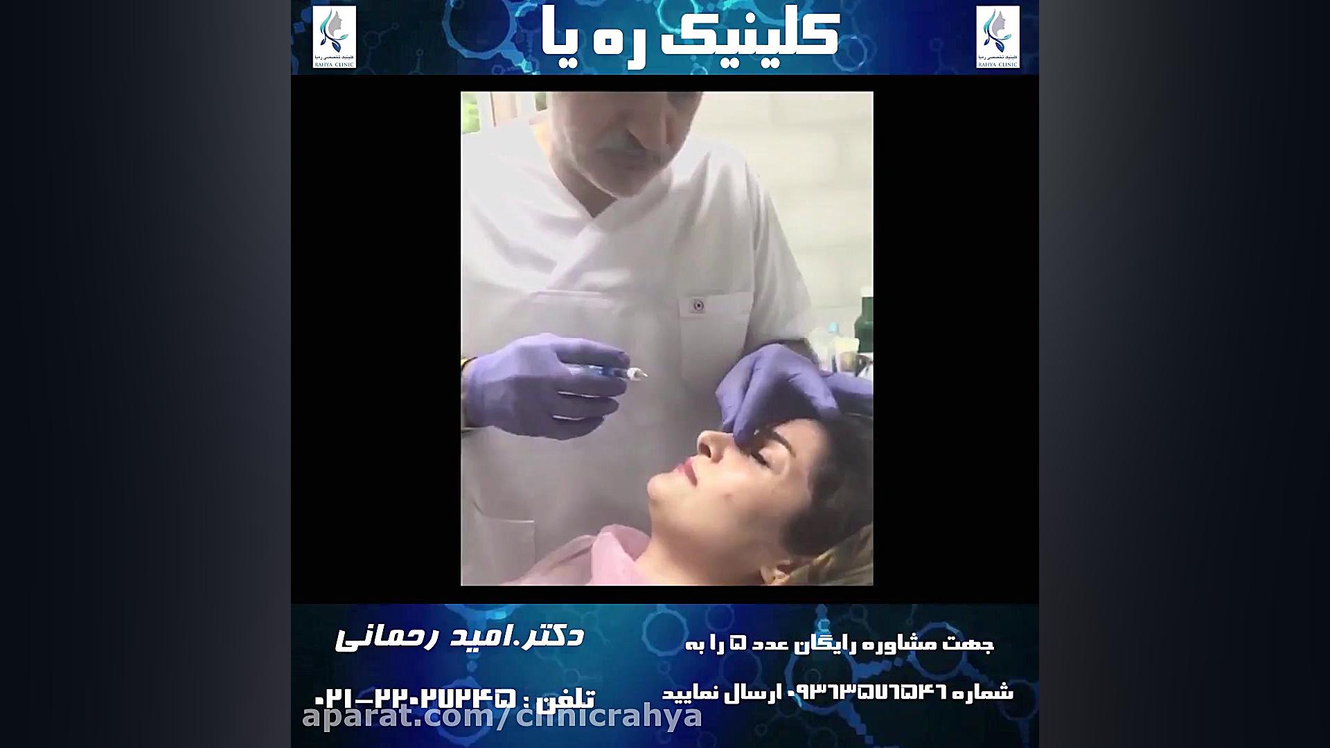 فرم دهی بینی با فیلر