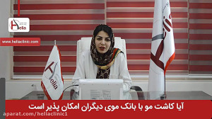 آیا کاشت مو با بانک موی دیگران...