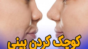 کوچک کردن بینی بدون عمل جراحی...