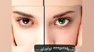 خطرات عمل تغییر رنگ چشم چیست؟