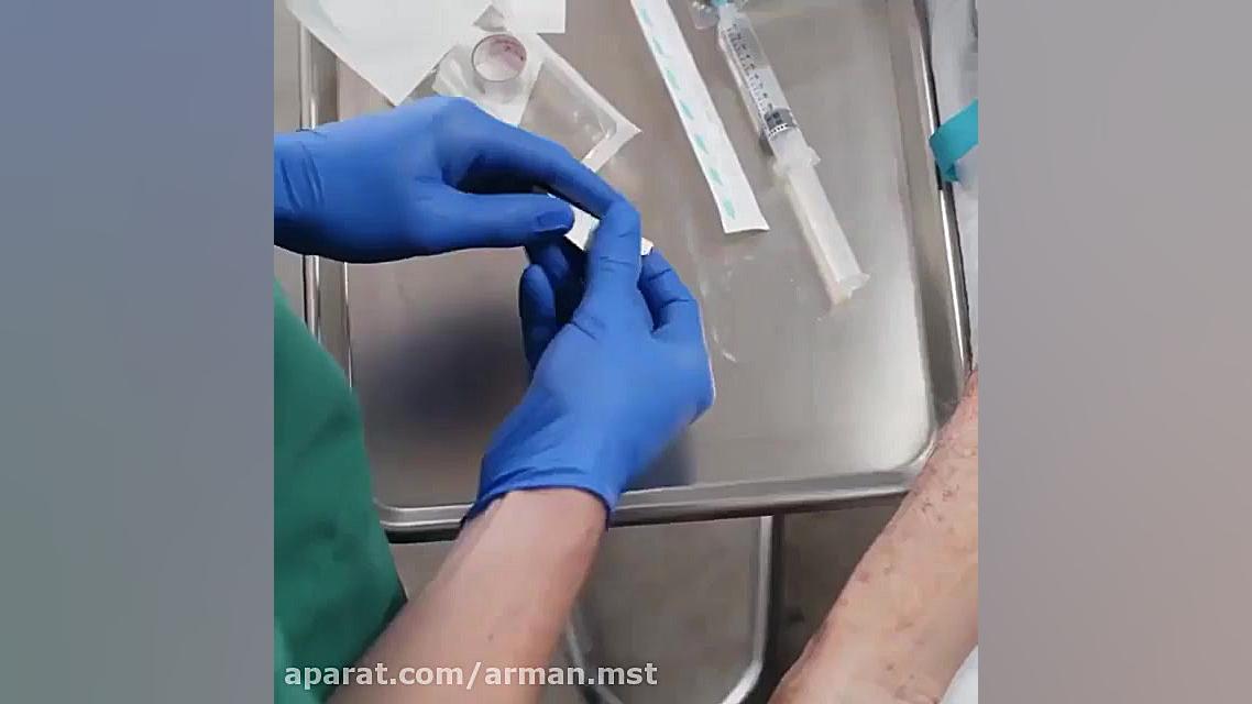 رگ گیری از کهن سالان