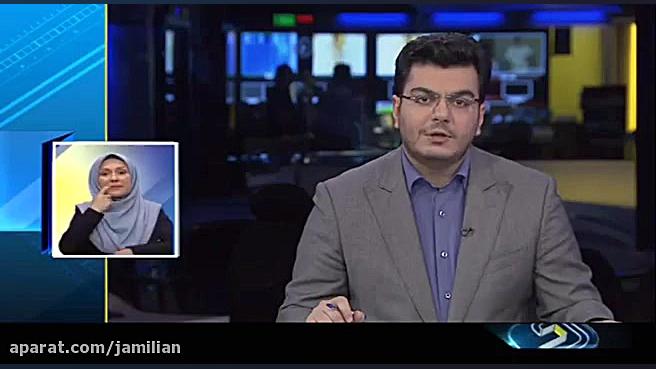 اصلاح عقب بودن فک با دستگاه جد...