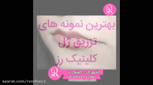 فیلم تزریق ژل | کلینیک رز | 02...