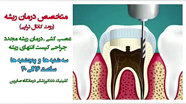 بهترین دندانپزشکی و عصب کشی دن...