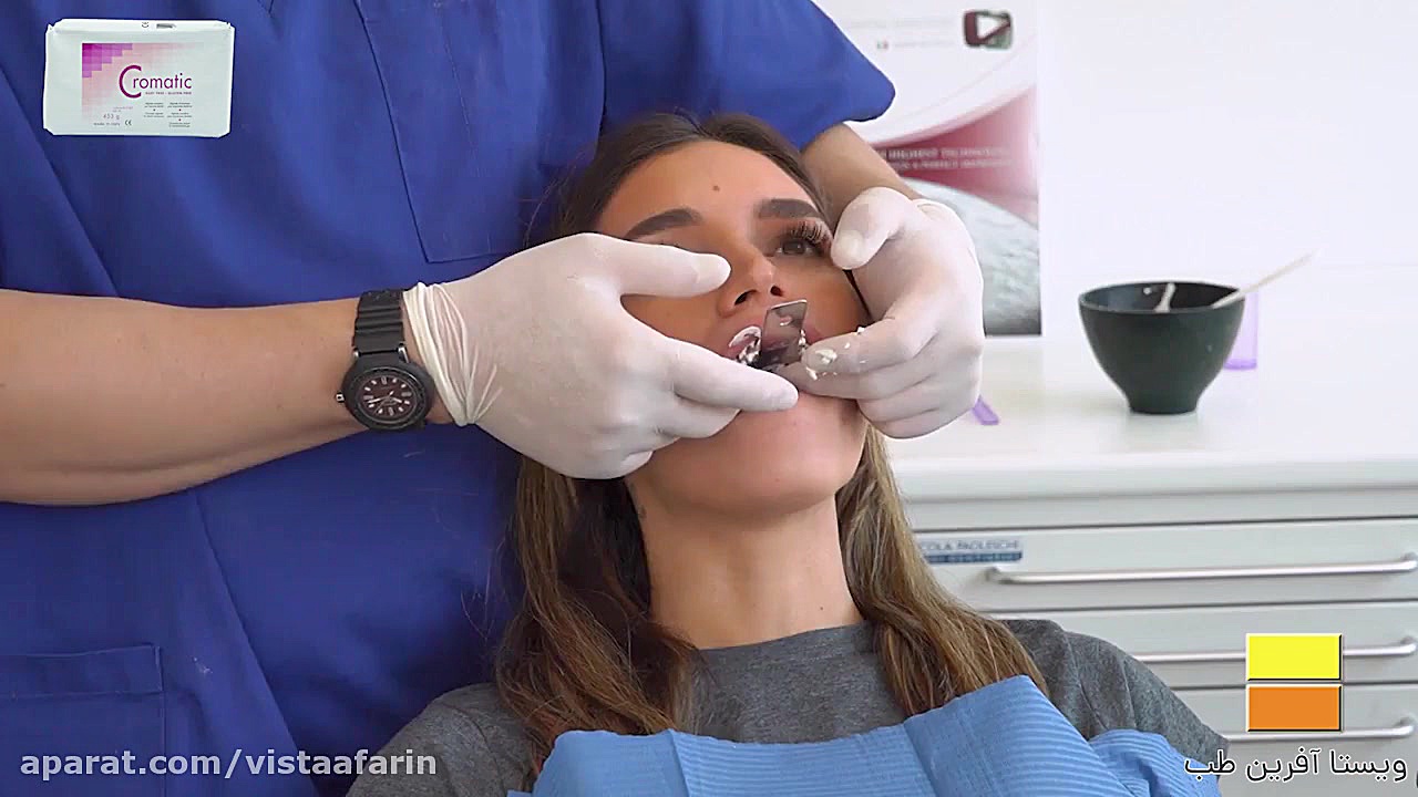آموزش استفاده از آلژینات کروما...