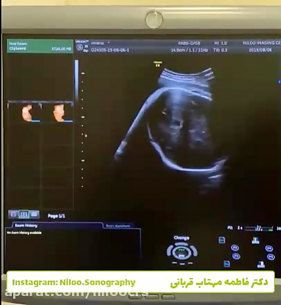 کنترل وزن جنین در هفته های آخر...