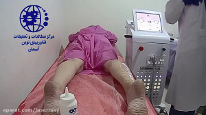 اموزش لیزر موهای زائد