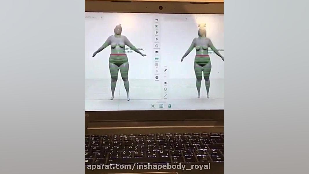 اسکن سه بعدی بدن