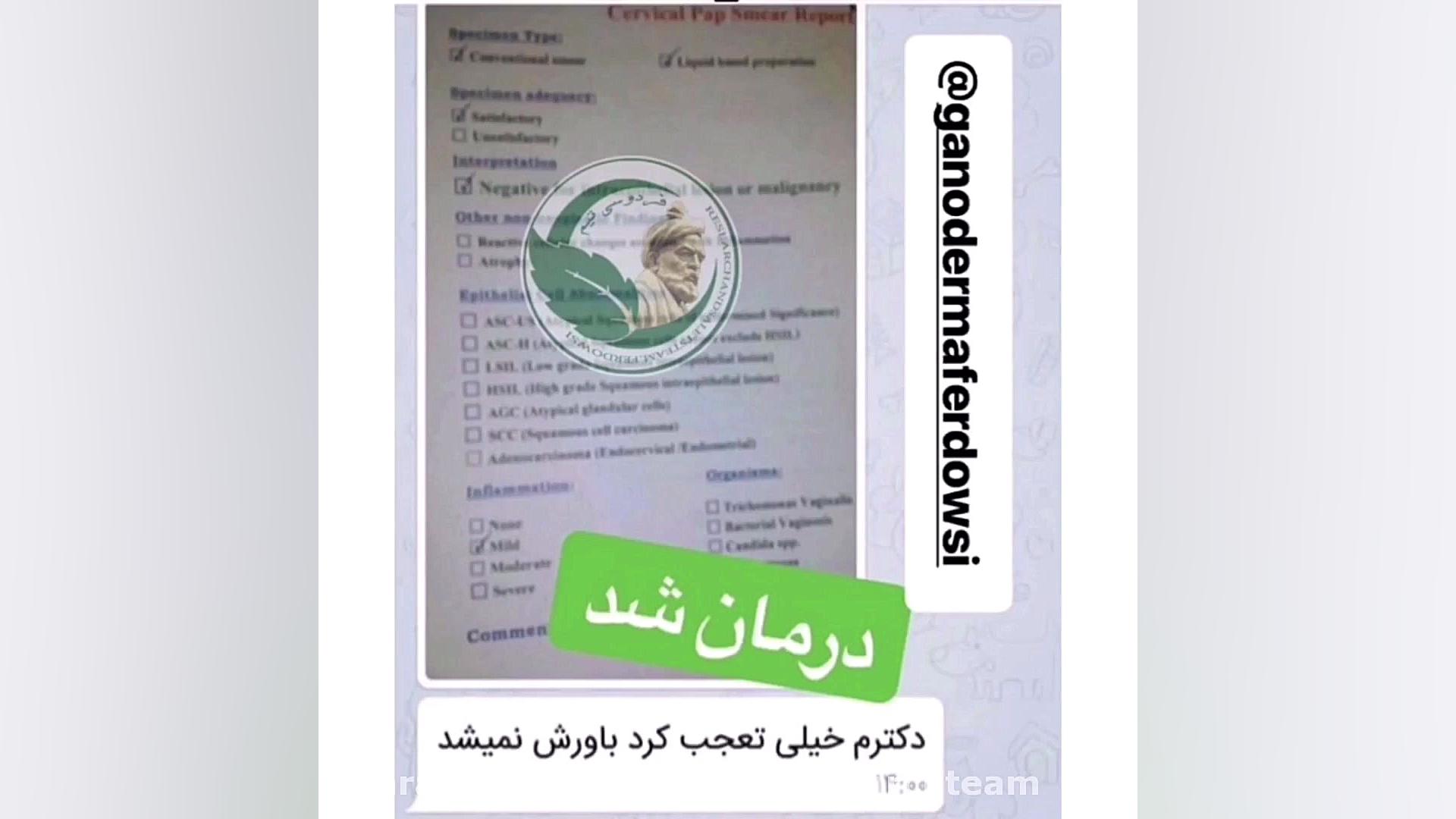 زگيل تناسلي درمان شد !!!!!!