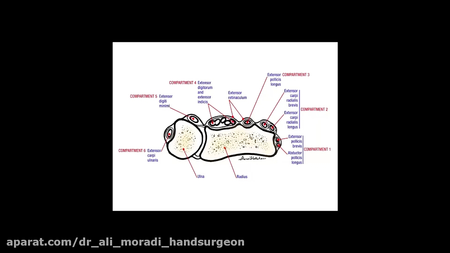 Extensor Tendon& 039;s Disease...